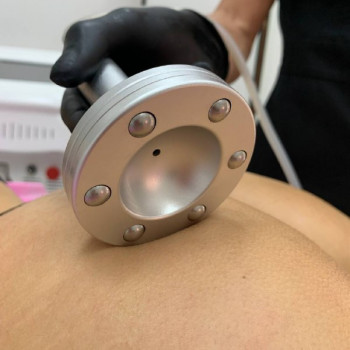 Магнитно-роликовый массаж (аппаратный)