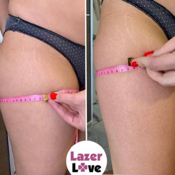 Обертывания STYX "До-После"