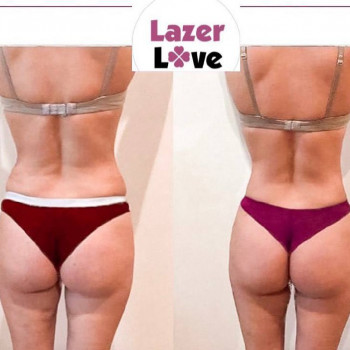 Обертывания STYX "До-После"