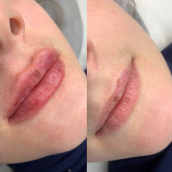 Massage Room, Житомир Фото - 13