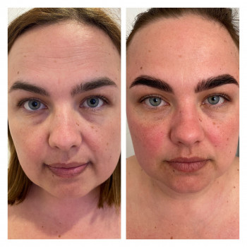 Испанский миофасциальный массаж лица
                    Масажист Татьяна Одеса