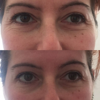 Испанский миофасциальный массаж лица
                    Масажист Татьяна Одеса