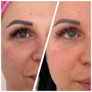 Испанский миофасциальный массаж лица
                    Масажист Татьяна Одеса