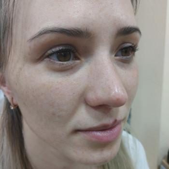 После ламинирования