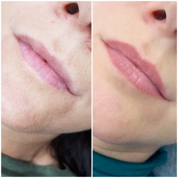 Заживший результат