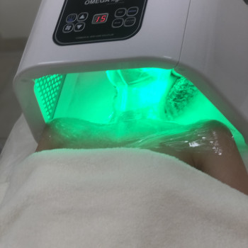 Фотодинамическая процедура с увлажняющей маской