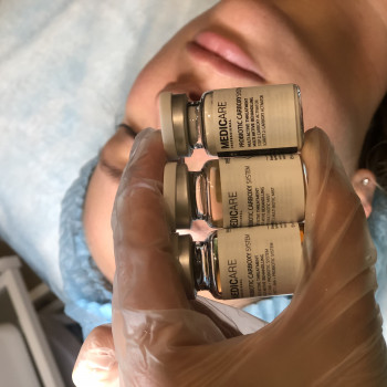 Карбокситерапия - одна из самых лучших методик для улучшения