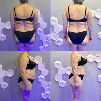 Проформа, Харків Фото - 6