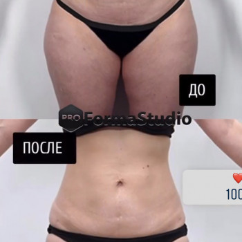 Проформа, Харків Фото - 7