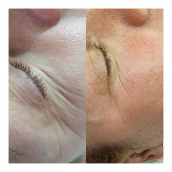 Валентина Стефанович, Кременчуг Фото - 5