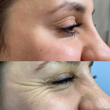 Олена Бойко, Львів Фото - 8