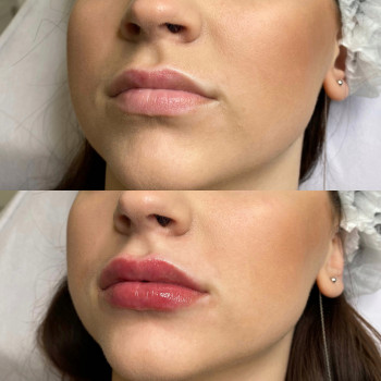 Олена Бойко, Львів Фото - 11