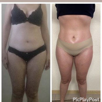 ЛЕПКА Ручной антицеллюлитный массаж
                    СПА-салон GARNA Мариуполь