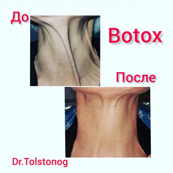 Світлана Толстоног, Одеса Фото - 10