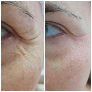 Светлана Чуйкова, Харків Фото - 6