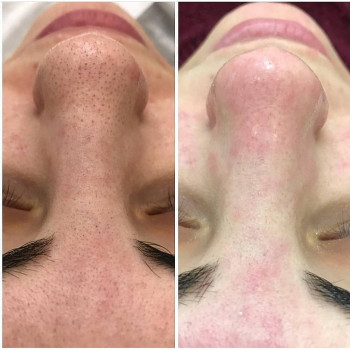 Светлана Чуйкова, Харків Фото - 7