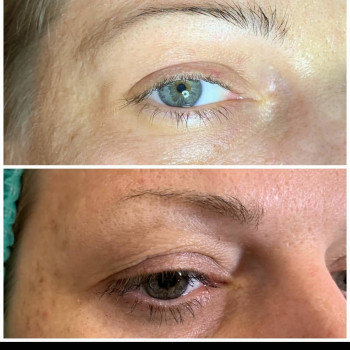 Светлана Чуйкова, Харків Фото - 14