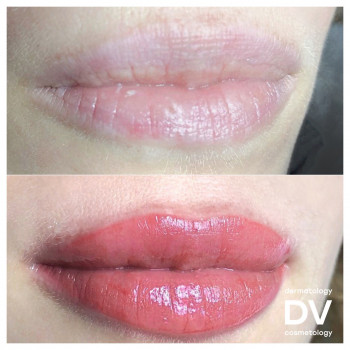 Перманентний макіяж губ (акварельна техніка).