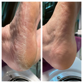 Лилия Середицкая, Одесса Фото - 9