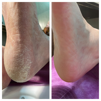 Лилия Середицкая, Одесса Фото - 31