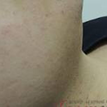 Лазерхауз, Краматорськ Фото - 9