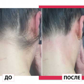 Лазерхауз, Краматорськ Фото - 14