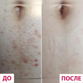 Лазерхауз, Краматорськ Фото - 15