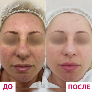 Лазерхауз, Краматорськ Фото - 17