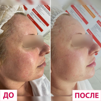 Лазерхауз, Краматорськ Фото - 20