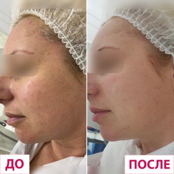 Лазерхауз, Краматорськ Фото - 22