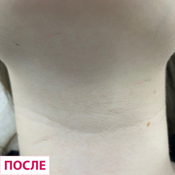 Лазерхауз, Краматорськ Фото - 24