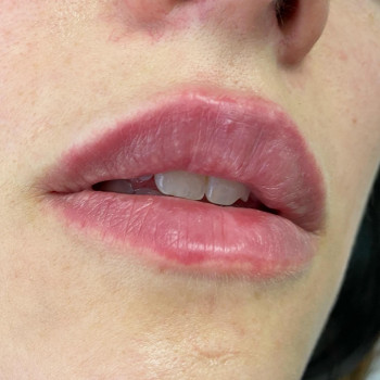 Center of Perfect Beauty, Винница Фото - 38