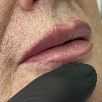 Center of Perfect Beauty, Винница Фото - 39