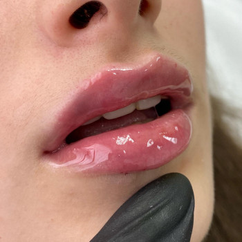 Center of Perfect Beauty, Винница Фото - 42