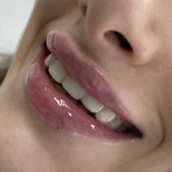 Center of Perfect Beauty, Винница Фото - 43