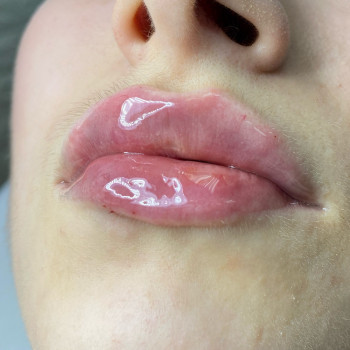 Center of Perfect Beauty, Винница Фото - 44