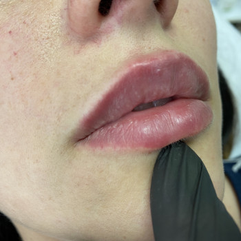 Center of Perfect Beauty, Винница Фото - 45