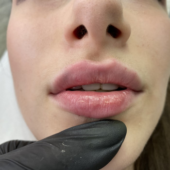 Center of Perfect Beauty, Винница Фото - 46