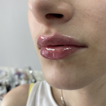 Center of Perfect Beauty, Винница Фото - 47