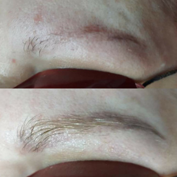 Лазерное удаление тату/татуажа
                    Мастер перманентного макияжа Анна Черкассы