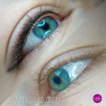 До и сразу после процедуры. После заживления будут бледне, 