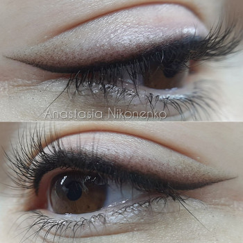 Сразу после процедуры, после заживления будет натуральнее !