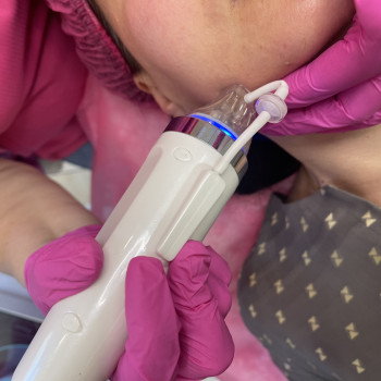 Фракционный РФ лифтинг
                    Косметологический центр Imbir studio Одесса