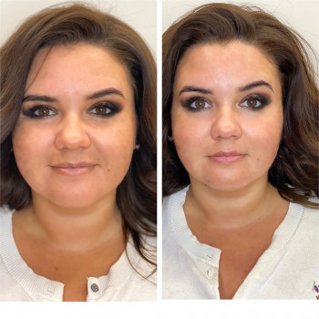 Смас лифтинг 4-d
                    Косметологический центр Imbir studio Одесса