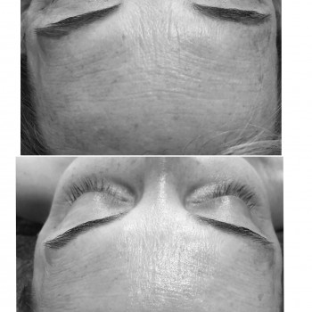 Lotus Massage Studio, Львов Фото - 9