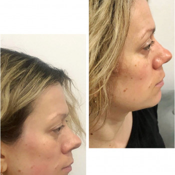 Lotus Massage Studio, Львов Фото - 12