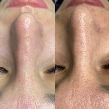 Вікторія Кушнір, Вінниця Фото - 13