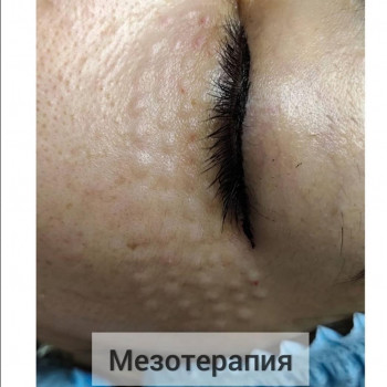 Екатерина Томарова, Херсон Фото - 12