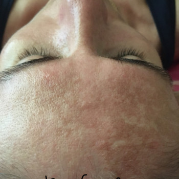 После чистки, конечный результат