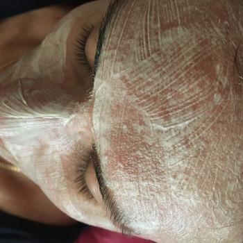 После чистки минеральная маска